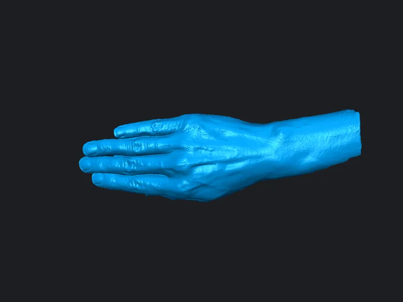 Hand and Wrist Scan